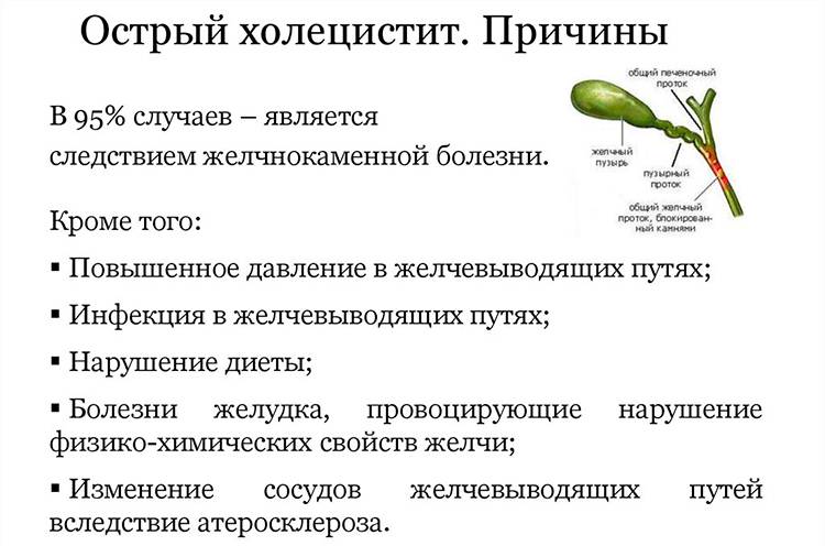 Хронический холецистит - симптомы болезни, профилактика и лечение хронического холецистита, причины заболевания и его диагностика на eurolab