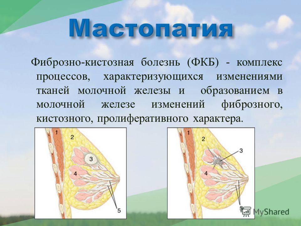 Мастопатия у кошек: симптомы и лечение