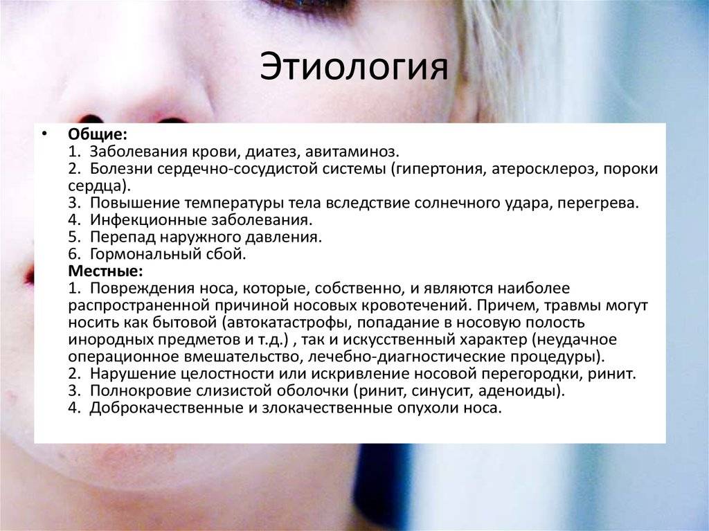 Кровь из носа у кота: причины, почему идет кровь, что делать