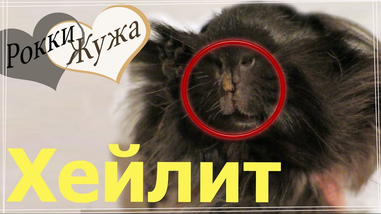 Хейлит - причины, симптомы, диагностика, лечение и профилактика